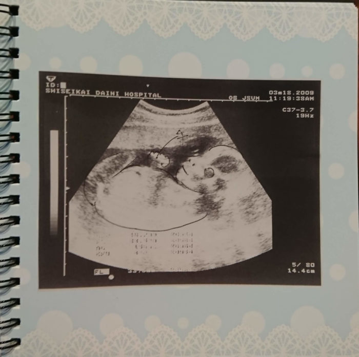 胎児のエコー写真が消える前に データ化 アルバムにしよう わが家のアルバムも紹介 ワンダフルライフ 妊娠 出産 産後 子育て 旅行